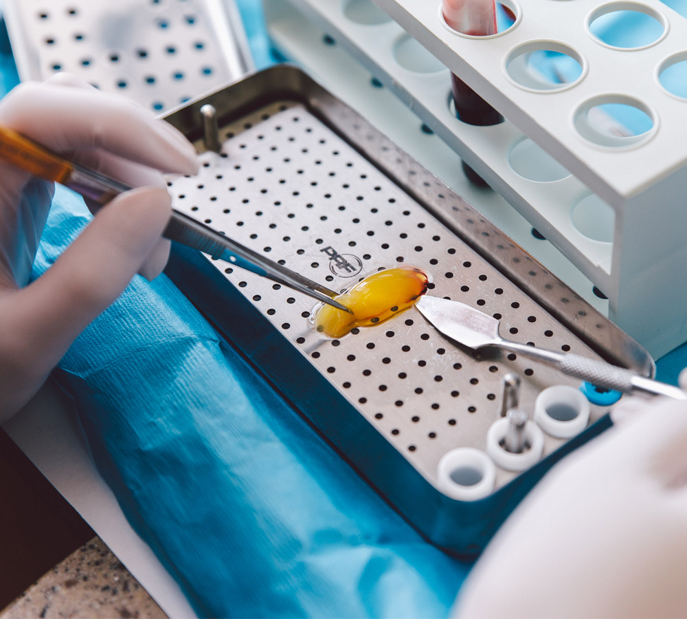 Plateletrich Fibrin Retter Dental Care